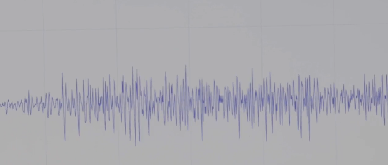 Raw sEMG waveform